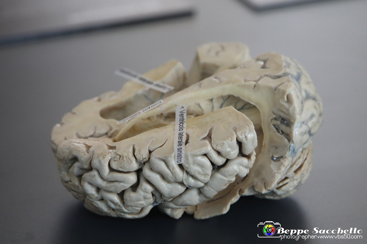 VBS_3007 - Ventricoli cerebrali - Mostra Body Worlds.jpg